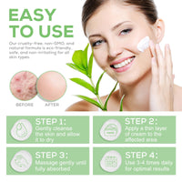 MINGYITUO Urea Foot Cream, Urea Cream 40 Percent for feet,with Hyaluronic Acid, Tea Tree and Aloe Vera,Heel Balm For Callous Removal and Soften, For dry, Cracked Feet, Heels and Hands (120g)