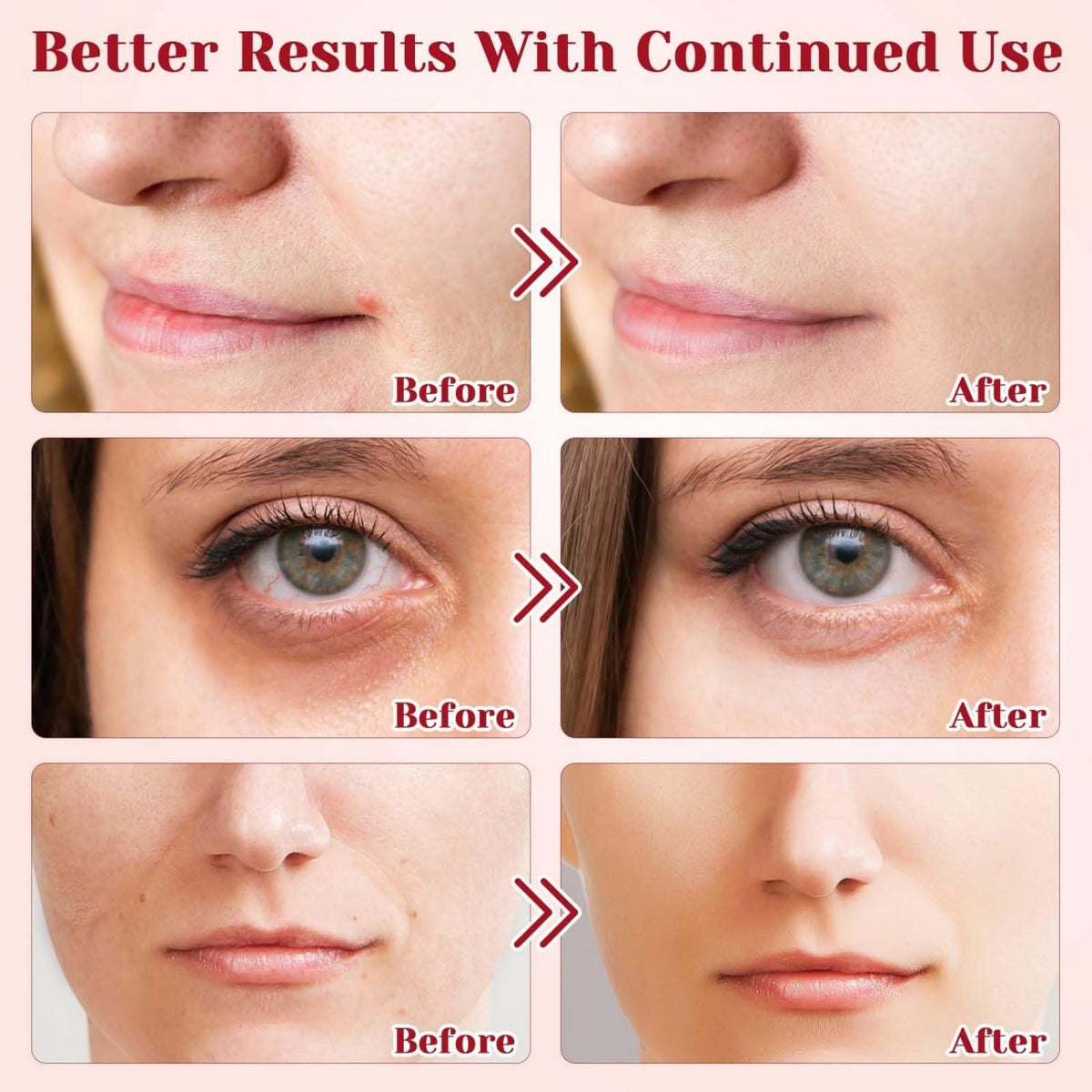Ruojiar Dragons Blood Easy Cream,Retinol Serum for Face,Dragons Blood Face Cream,Retinol Placenta Dragon Blood Cream,Dragon Blood Serum Face Moisturizer,Anti Aging Face Cream,Face Serum for Women,Skin Serum