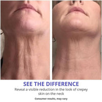 NLFOX Neck Firming Cream - Neck Cream for Crepey Skin Body Care Comfort - Collagen & Hyaluronic Acid Neck Tightening Cream - Tighten and Lift Neckcream for Women & Men on neck & Décolleté Lifting