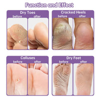 Generic 2 Pairs Foot Peel Mask for Hard Skin,Lavender Exfoliating Mask for Callus Remover Dead Dry Skin,Cracked Heel Treatment Socks, Plant Formula Moisturising Socks, Soft Foot Care
