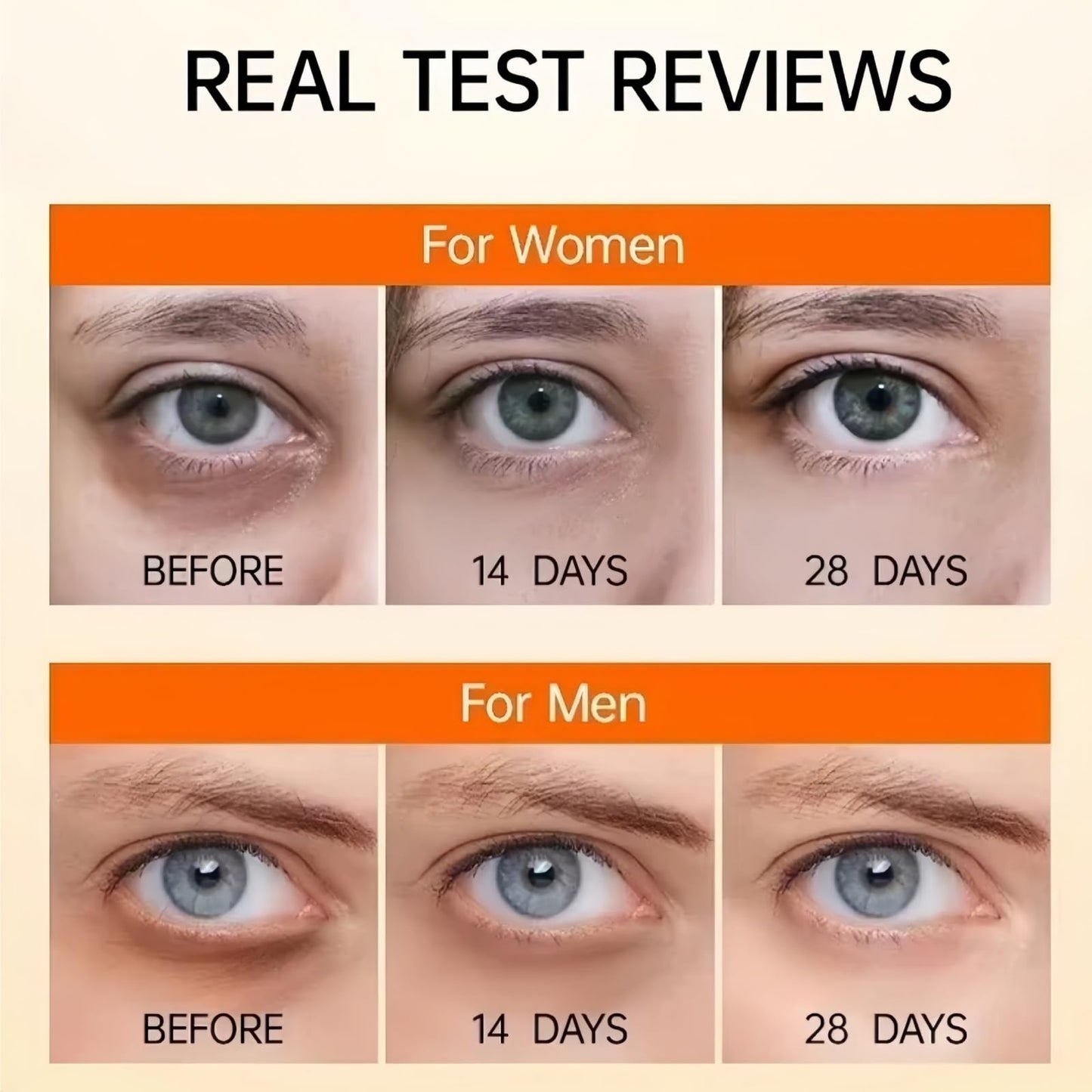 Lutein Eye Essence Oil,Anti-Aging Eye Cream & Serum for Dark Circles, Wrinkles, Puffy E/yes, Men & Women, Vitamin C Treatment,Ey/e Bag Remover, Under Ey/e Roller,Dark Circle Treatment,Anti Wrinkle