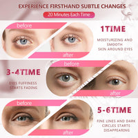Coukula Pink Undereye Mask (60 Pcs), Collagen Hydrating Gel Pads, Reduce Puffiness, 30 Pairs Under Eye Patches for Dark Circles Puffy Eyes Treatment, Wrinkle, Women Men Beauty Personal Skin Care Products