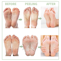 AuraAnge 4 PCS Aloe Vera Foot Peel Mask - Exfoliating Socks for Callus Removal - Cracked Heels, Dead & Dry Skin. Moisturizing for Soft, Smooth Feet