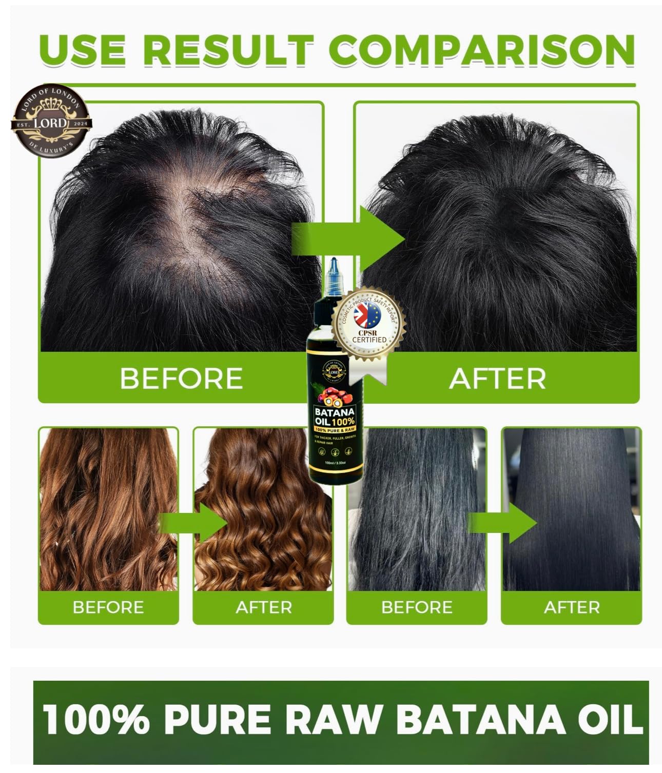 Lord of London Lord Batana Oil 100% Raw & Pure for Hair Growth, Gair treatment, 100ml, Chemical-Free Hair Oil for Thicker Fuller Hair