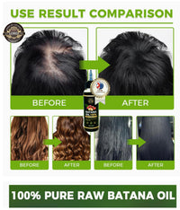 Lord of London Lord Batana Oil 100% Raw & Pure for Hair Growth, Gair treatment, 100ml, Chemical-Free Hair Oil for Thicker Fuller Hair