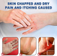 Intensive 60% Urea Cream for Extremely Dry, Cracked Skin – Deeply Moisturizing Foot & Hand Balm. Fast-Acting Repair for Rough Heels, Knees, Elbows & Hands、Severe Dryness