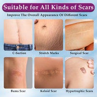 Eveellyn Scar Cream, Scar Gel, Professional Scar Removal Cream for Surgical Scars, Stretch Mark, Keloid Bump, C-Section, Burn, Acne, Old and New Scars 1.7 oz (50g)