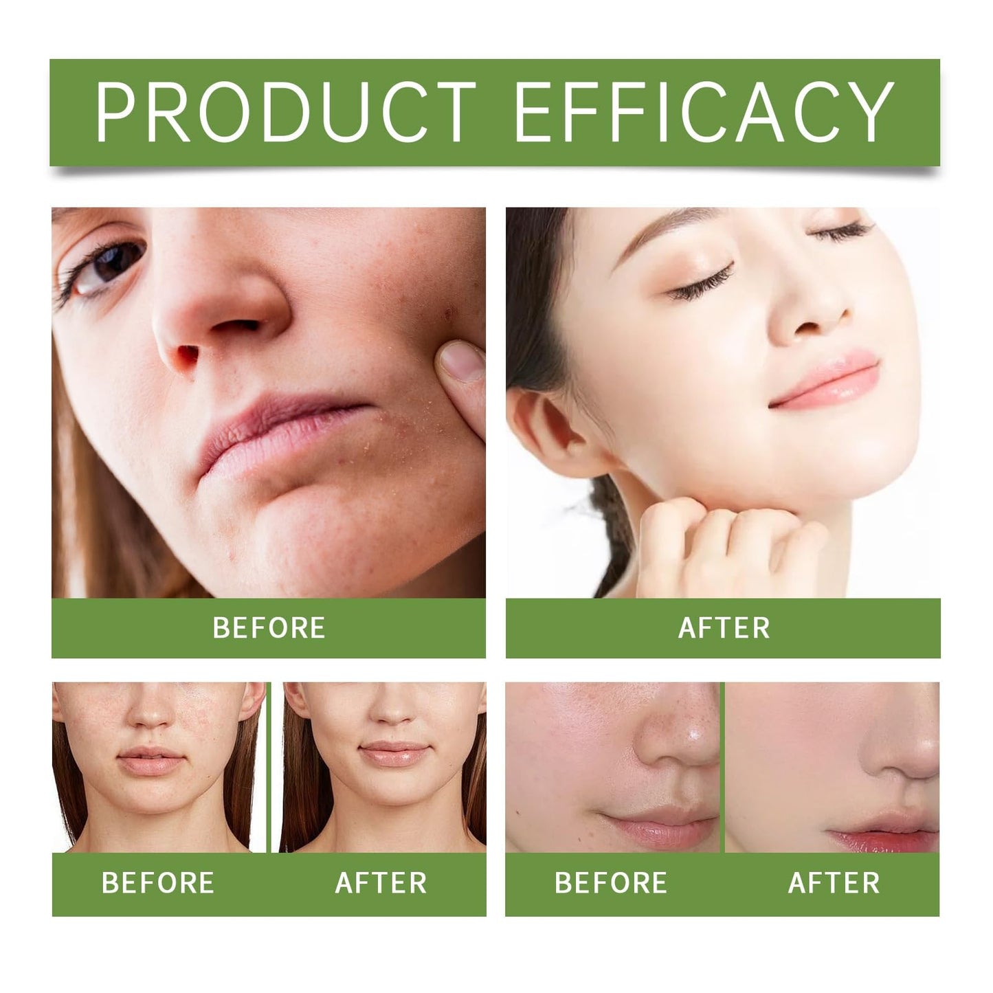 Purifying Exfoliating Gel,Exfoliating Face Wash Gels,Face Scrub Exfoliator,Deep Cleansing Face and Body Exfoliating Scrub Gel,Moisturizing Facial scrub Gel,Gentle Exfoliating Facial Cleanser