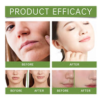 Purifying Exfoliating Gel,Exfoliating Face Wash Gels,Face Scrub Exfoliator,Deep Cleansing Face and Body Exfoliating Scrub Gel,Moisturizing Facial scrub Gel,Gentle Exfoliating Facial Cleanser