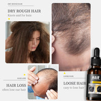 Hair Growth Serum Anti Hair Loss Hair Oil, Organic Natural Hair Loss Treatment for Thin Dry Hair, Nursing Scalp, Promote Natural Hair Growth, Regrowth Hair Serum for Men and Women