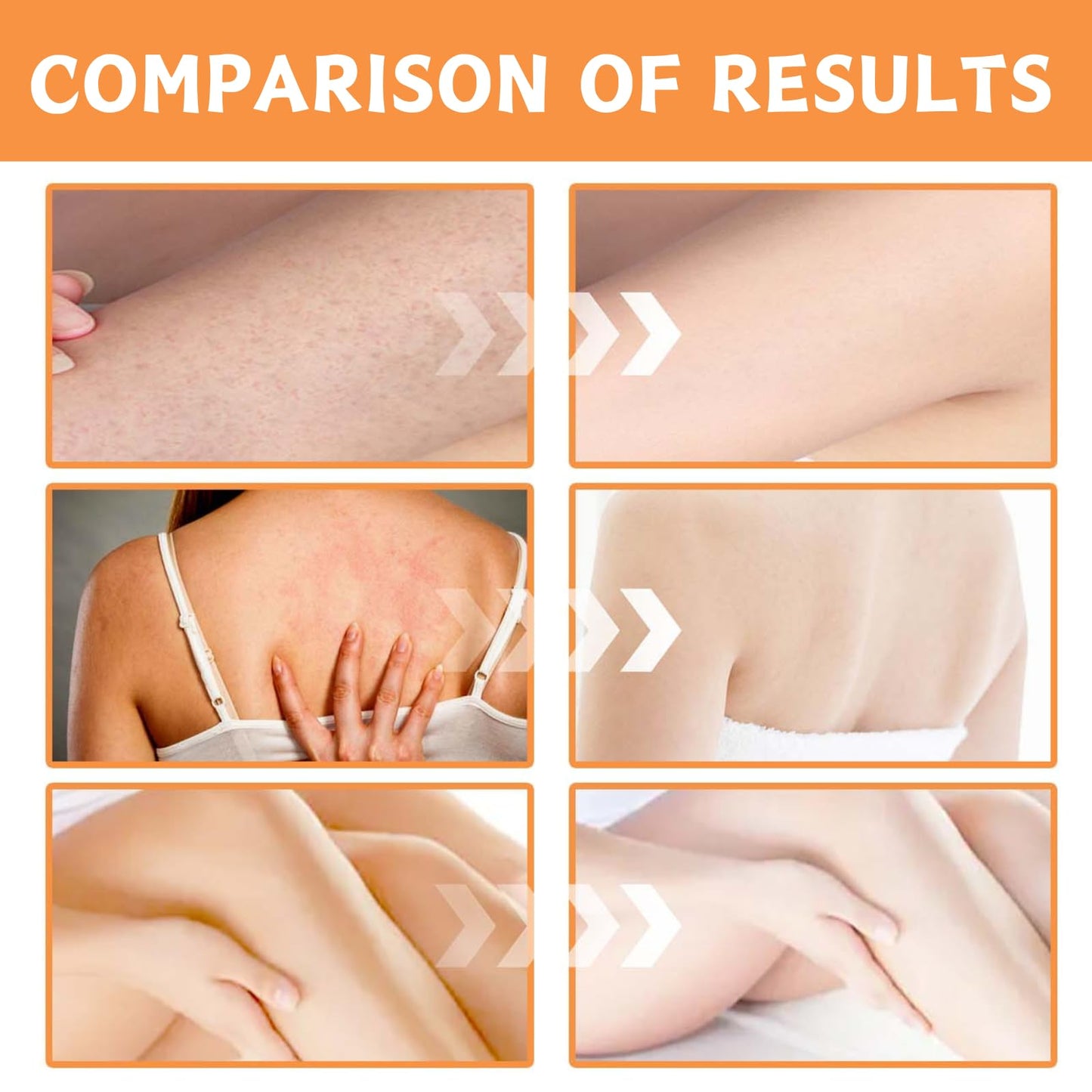 Vitamin C Oil, Vitamin C Body Oil, Organic Vitamin C Massage Oil, Body Moisturiser, Brightening Body Oil, Face&Body Skin Care - Massage Body Oil for Dry Skin Easy Absorb&Anti Winkle