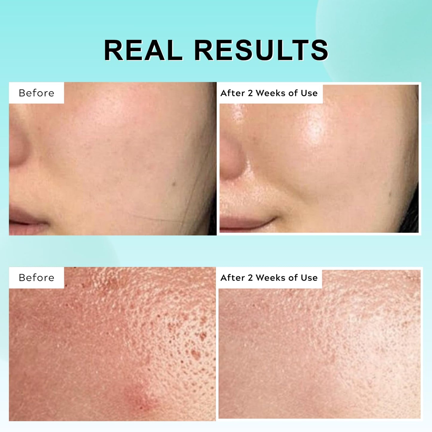 Lumiter PDRN 100 Essence, PDRN Serum Korean, Intensive Glow Serum for Face Glass Skin, Smooth Fine Lines, Boost Elasticity, Skin Restoration & Plumping, Hydrating & Moisturizing, 30ml