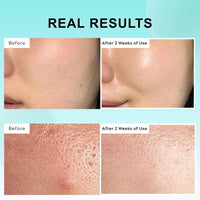 Lumiter PDRN 100 Essence, PDRN Serum Korean, Intensive Glow Serum for Face Glass Skin, Smooth Fine Lines, Boost Elasticity, Skin Restoration & Plumping, Hydrating & Moisturizing, 30ml