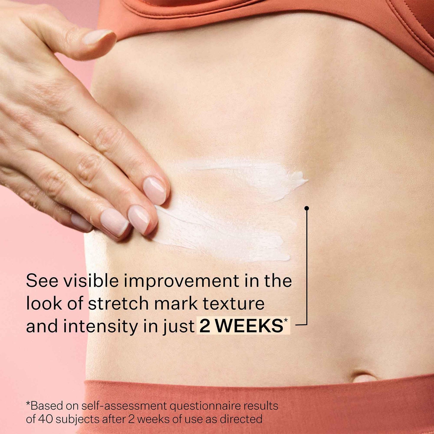 StriVectin SD Advanced™ Plus Intensive Moisturizer for Wrinkles & Stretchmarks, For Face & Body, Collagen Boosting with Peptides & Hyaluronic Acid