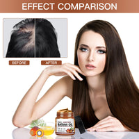 Angozo Batana Oil for Hair Growth,120ml Organic Batana Oil,Repairs Damaged Hair,Eliminates Split Ends and Enhances Hair Thickness for Healthier,Thicker