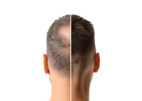 RESTRAND Hair Building Fibres. The Latest Generation of Fibres. Instantly Hide Hair Loss. 14 Colours Available, Large 28g Pot. (Very Dark Brown)