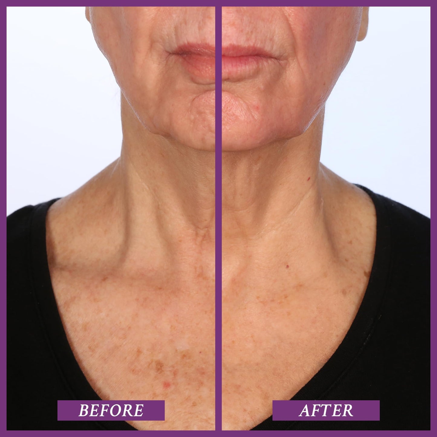 PRAI Ageless Throat & Decolletage Creme (50ml) with Shea Butter and Hyaluronic Acid for Long Lasting Hydration