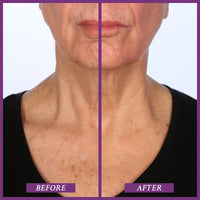 PRAI Ageless Throat & Decolletage Creme (50ml) with Shea Butter and Hyaluronic Acid for Long Lasting Hydration