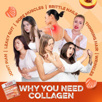 supplmnt. Supplmnt. Marine Collagen Gummies, Hydrolysed Collagen Peptides w/Biotin, Hyaluronic Acid & Vitamin C, Collagen Supplements for Women & Men, Collagen for Skin, Hair & Nails (One Size, Peach)