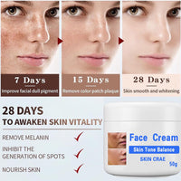 GNAUMORE Dark Spot Corrector Cream,Sun Spots and Melasma Freckle Remover,Spot Remover For Face Serum,Moisturizing Removes Facial Melasma Dark Spots Wrinkles Blemishes 50G