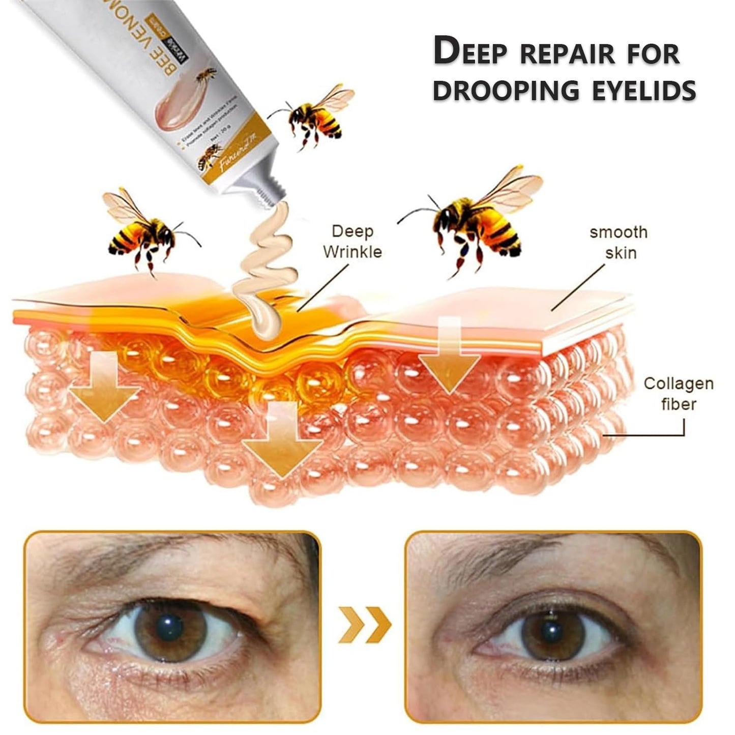 RuverLand 4 PCS Bee Venom Cream Anti-Wrinkle, Face and Neck Cream Moisturiser, Wrinkle Removal & Firming, Moisturizing, Lifting & Recovery for All Skin Type, Anti-Aging Bee Venom Cream