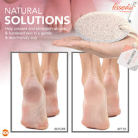 2pk Natural Pumice Stone for Feet | Callus Remover Feet Scrubber Dead Skin Pumice Stones | Foot Scrubber Pumice Stone Feet | Foot Pumice Stone for Hands Foot Stone Pumice for Hard Skin + SOL Sticker