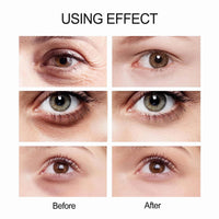 mercham Anti Wrinkle Eye Cream, Electric Under Eye Cream for Dark Circles Puffy Eye