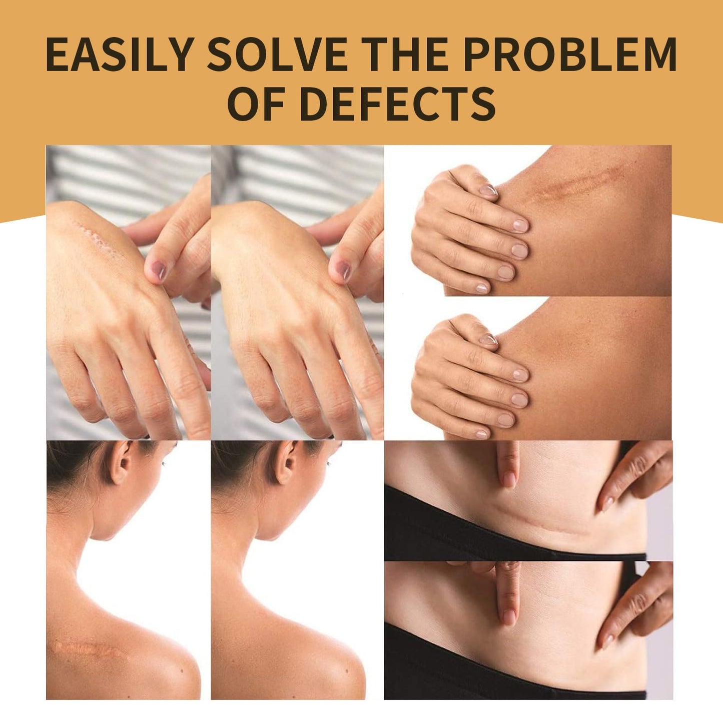 SHEBEEDO 10 PcsTattoo Cover Up Patch,High Coverage Ultra-Thin Skin Tattoo Cover Up Patch For Tattoos Scars Birthmarks Dark Spots, Long-Lasting Wear Waterproof,Seamless Makeup Stickers For Flawless Coverage