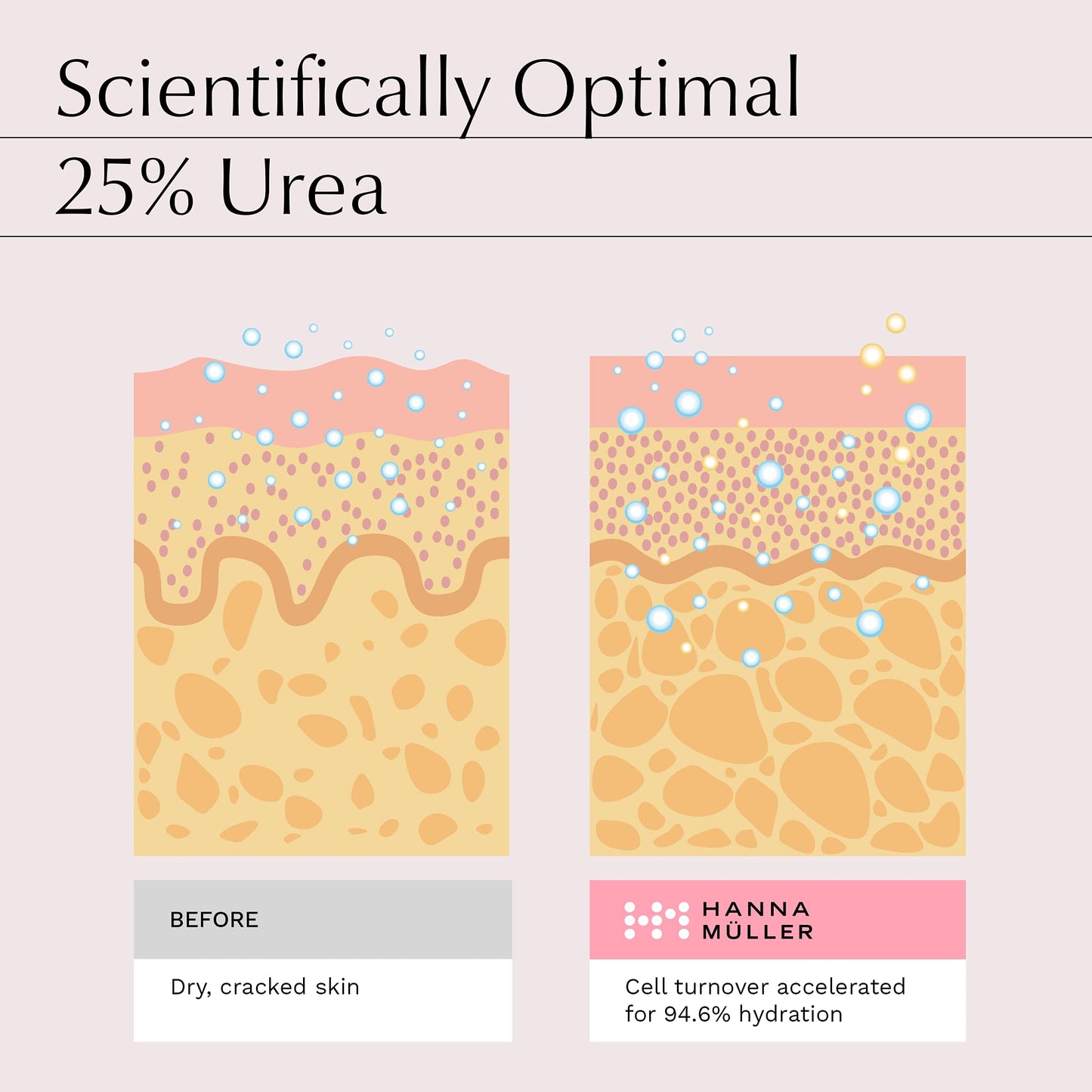 Hanna Müller 3 Pairs Foot Peel Mask - Foot Exfoliator and Foot Peel Mask for Hard Skin and Cracked Heel, Foot Masks with AHA Blend, Salicylic Acid, Botanical Extracts, Vitamin C and A, Feet Peeling Mask