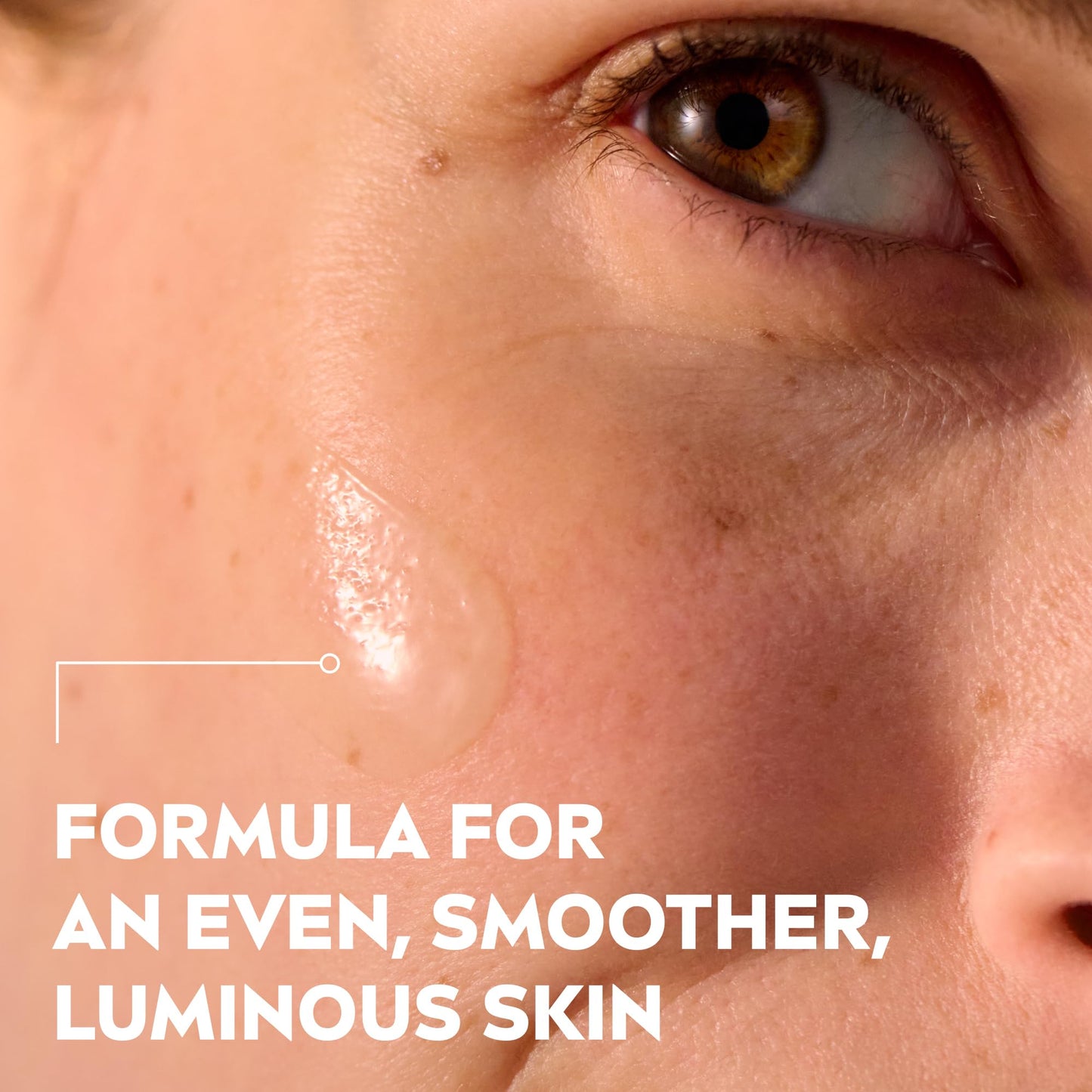 NIVEA LUMINOUS 630 Anti Dark-Spot & Post-Acne Marks Serum (30ml), Face Serum Visibly Reduces Post-Acne Dark-Spots, Contains Salicylic Acid and Hyaluronic Acid