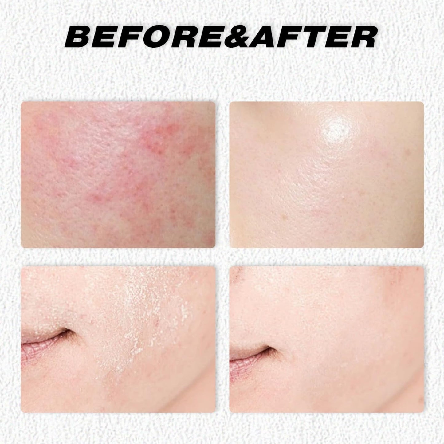 LaluluTek Grass-Fed Tallow Balm for Face & Body - Deeply Nourishing Moisturizer with Beef Tallow, Ideal for Dry Skin Care