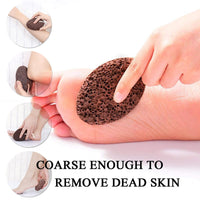 PHOGARY Natural Pumice Stone for Feet, 1 Pack Volcanic Lava Foot Stone Pedicure Tools Hard Skin Callus Remover for Feet and Hands - Natural Foot File Exfoliation to Remove Dead Skin-Black Foot Pumice