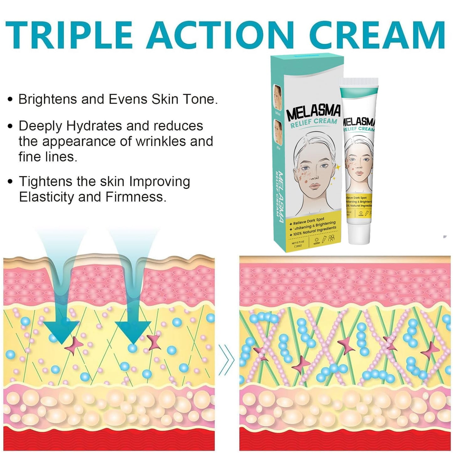MEITREND Melasma Treatment For Face,Dark Spot Remover for Face & Body, Pigmentation Removal Cream,Corrector For Age Spots Sun Spots Freckles Melasma Brown Spots,Freckle Removal Cream