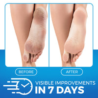 Imperial Feet Urea Foot Balm - Natural Urea Cream for Rough & Dry Skin, Calluses - Cracked Heel Treatment with Cleansing, Moisture-Binding Exfoliating Formula - Wild Herb Antioxidant Extract - 150ml
