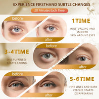 Mifeloy 60 Pcs 24K Gold Under Eye Patches, 30 Pairs Women Undereye Mask for Puffy Eyes Dark Circles Treatment, Beauty Skin Care Products, Men Collagen Gel Pads Hydrating for Eye Bags Puffiness Wrinkle