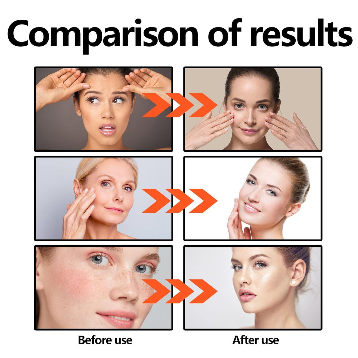 Jinjiar Bee Venom Skin Cream,Multi-Effect All-in-One Skincare Cream,Bee Venom Cream,Powerful All-Body Skin Cream,Face Cre-am for Women,Moisturiser Face Women,Fa-ce Tightening Cr-eam,Skin Firming Cre-am