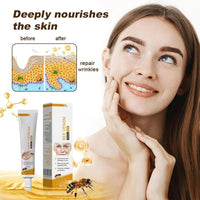 TBLMPNE 2Pcs Furzero Bee Venom Wrinkle Removal Cream, for All Skin Types