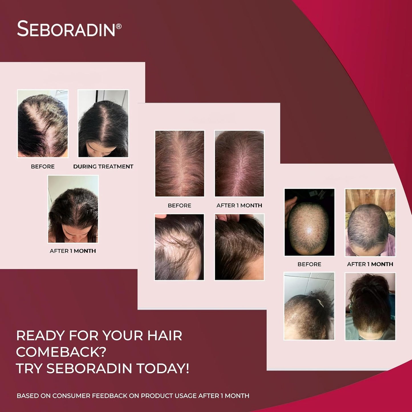 SEBORADIN Seboradin Forte Hair Growth Serum Ampoules 14 x 5,5 ml Anti Hair Loss Serum Chronic Hair Loss and Thinning Treatment Natural Extracts and Vitamins Hair & Scalp Treatment Hair Care & Products