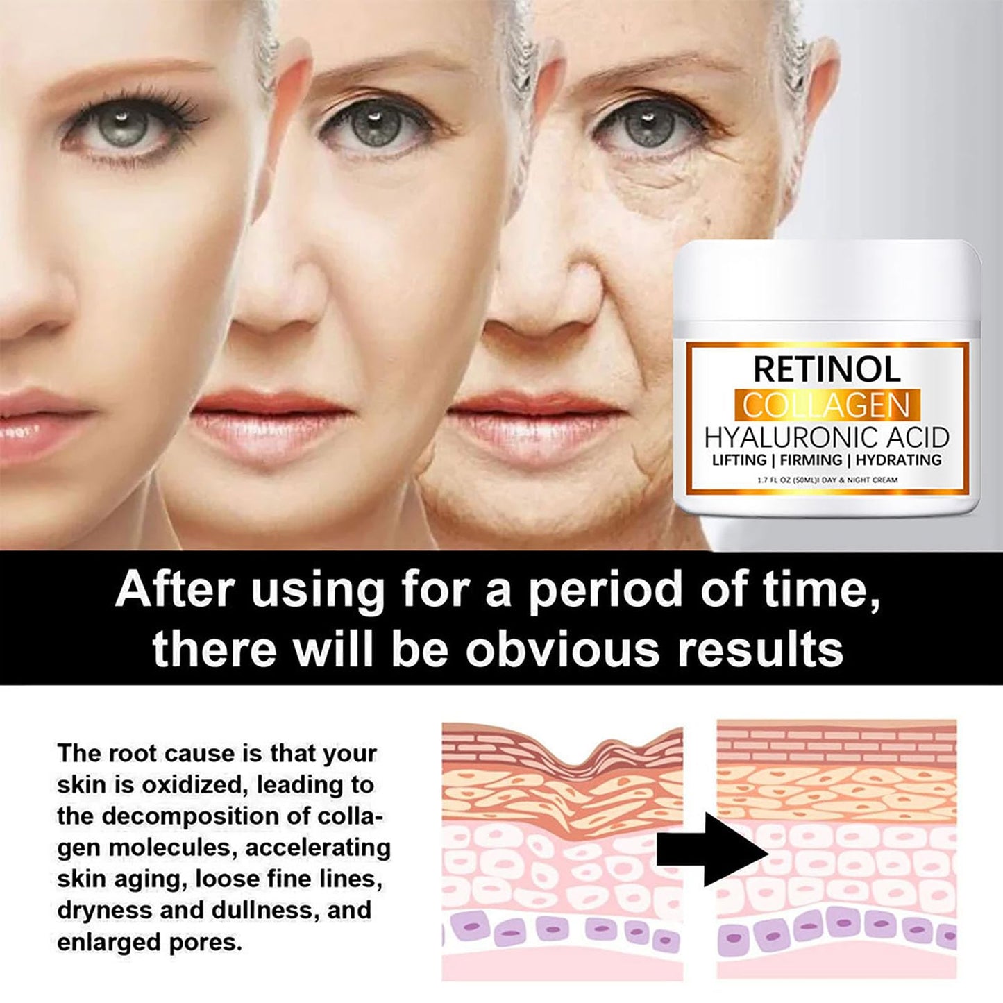 Retinol Collagen Cream for Face - 2PCS Retinol Cream with Hyaluronic Acid & Vitamin E - Anti Wrinkle Face Cream - Skin Lightening Cream - Dark Spot Remover - Anti Aging Face Cream for Day & Night