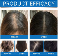 DAMIGHT 2Pcs Seapuri Scalp Serum, Scalpy Hair Growth Serum for Hair Loss, Scalp Cooling Hair Ampoule, Scalp Massager Treatment for Women and Men, Non-Greasy, Lightweight, Exfoliate Dandruff (C)