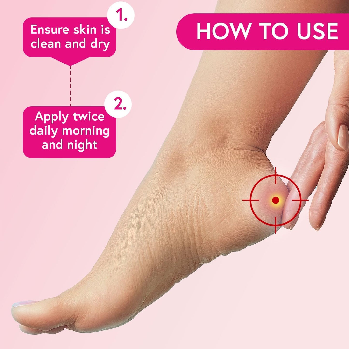 CARNATION FOOTCARE Cracked Heel Cream, Revives Rough, Dry and Cracked Heels, Moisturises, Rehydrates Dry Callused Feet with Refreshing Peppermint Oil with 20% Urea, 50ml