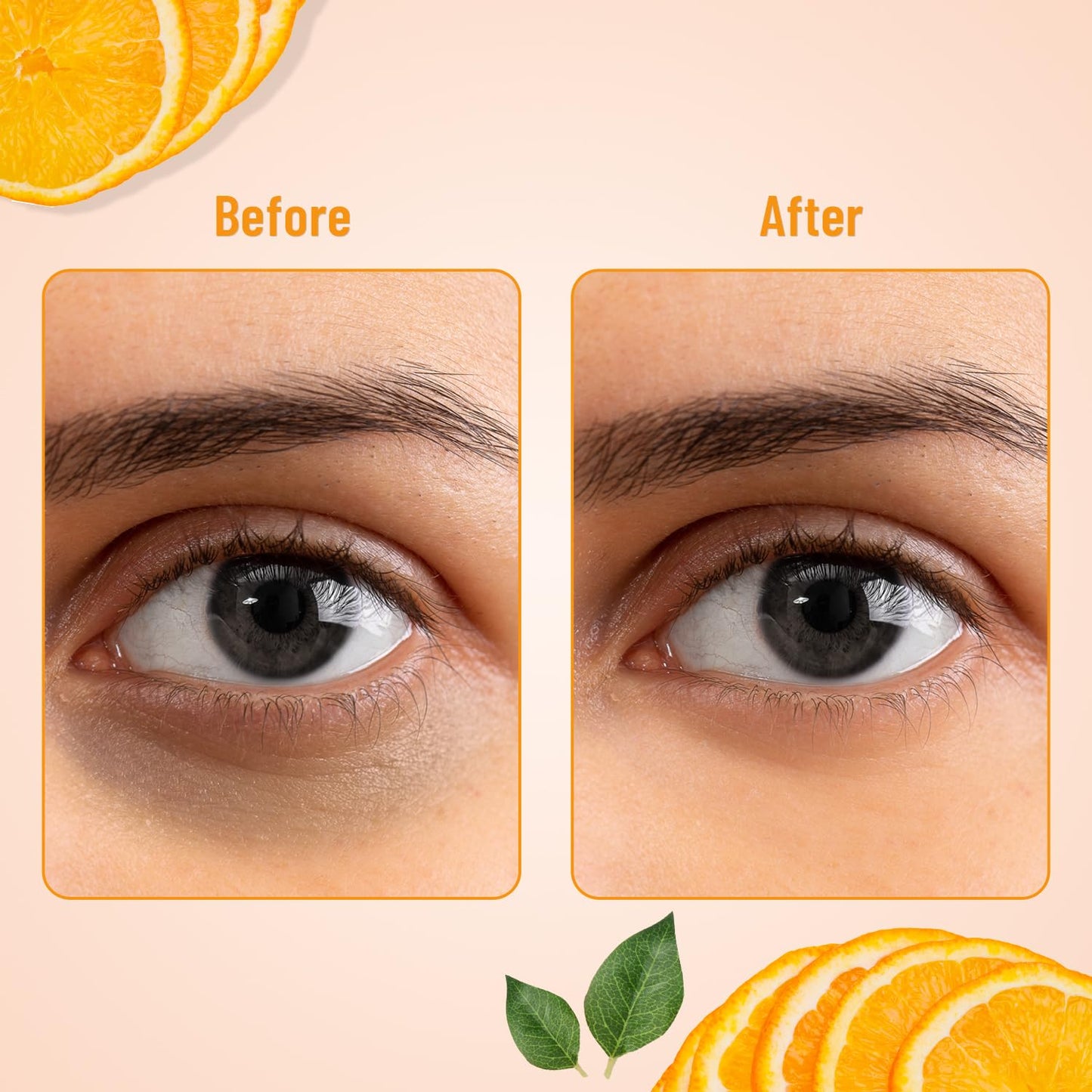 Swiss Beauty Hydra Anti Wrinkle Eye Serum Patch| Treats Dark Circles, Fine Lines And Wrinkles | Enriched With Collagen And Aloe Vera Extract | Shade -Gold, 60 Pcs by Glowrity