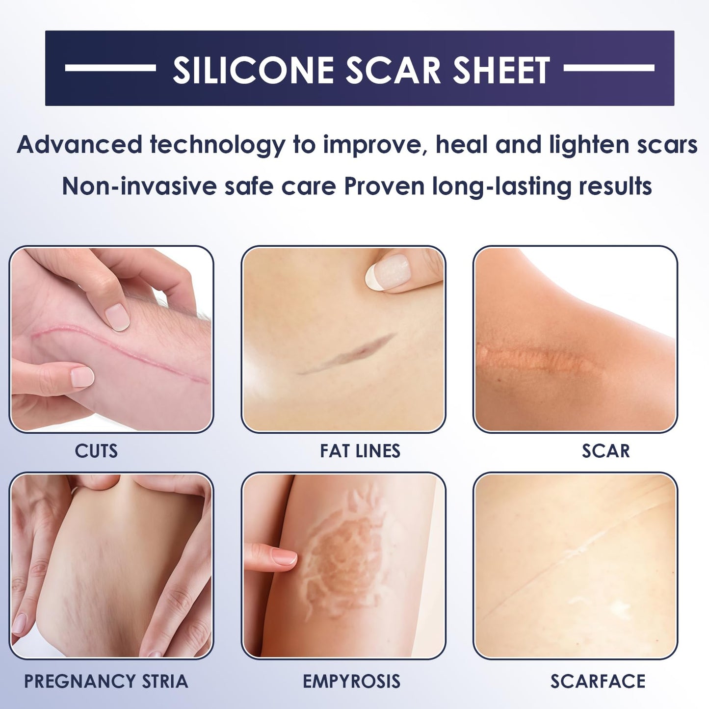 Uheltosly 30g Scar Gel, Scar Cream, Mild and Moisturizing Scar Removal Cream, Stretch Mark Cream, Recovery for Old and New Scars