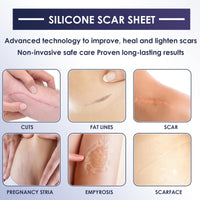 Uheltosly 30g Scar Gel, Scar Cream, Mild and Moisturizing Scar Removal Cream, Stretch Mark Cream, Recovery for Old and New Scars