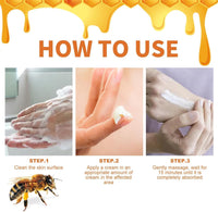 Generic 2PCS 30g Bee Venom Psoriasis Cream, Cvreoz Bee Venom Psoriasis Cream, New Zealand Bee Venom Cream, Fast-Acting Relief Bee Venom Cream Psoriasis Treatment Cream, Soothing Psoriasis Cream（30g*2pcs)