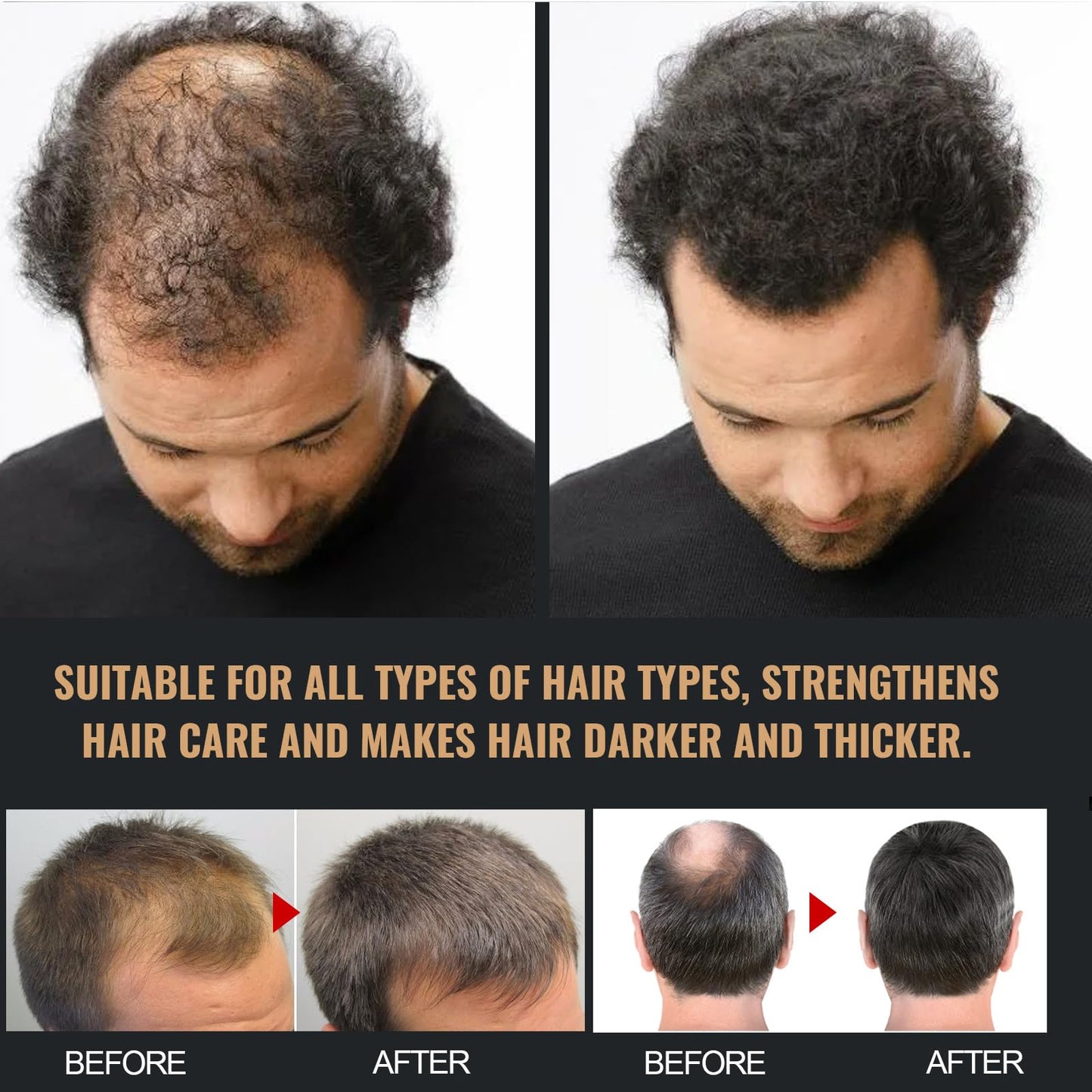 KOAHDE Man Root Activator Shampoo,Root Activator Shampoo,Root Activator Shampoo for Men,Hair Growth Shampoo,Shampoo for Thinning Hair and Hair Loss,Natural Herbal Essence Shampoo,with Scalp Comb