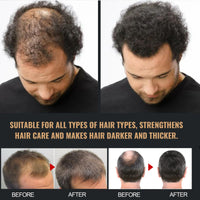 KOAHDE Man Root Activator Shampoo,Root Activator Shampoo,Root Activator Shampoo for Men,Hair Growth Shampoo,Shampoo for Thinning Hair and Hair Loss,Natural Herbal Essence Shampoo,with Scalp Comb