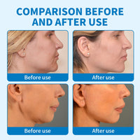 Leogony 2 PCS V Line Face Lifting Chin Mask, Double Chin Lifting Mask, Firming and Moisturizing