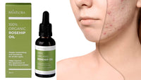 Miaflora Organic Rosehip Oil 30ml