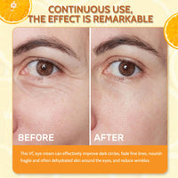 Trendyfave Vitamin C Eye Cream, Under Eye Cream for Dark Circles and Puffy Eyes, Eye Bags Remover, Hydrating Eye Cream, Fade Fine Lines, Anti Aging Eye Cream for All Women Men Skin